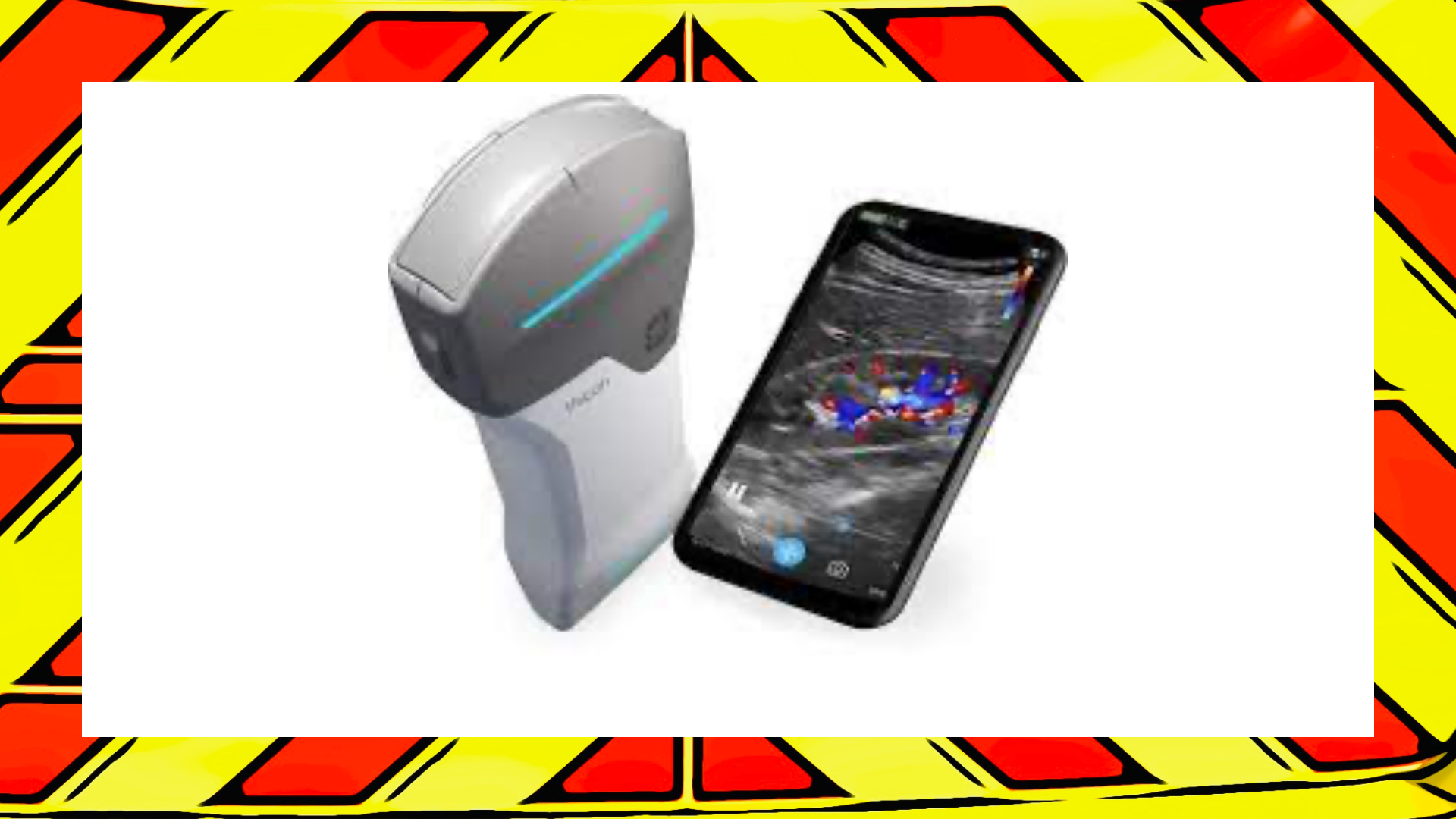 Icon Ultraschall.png